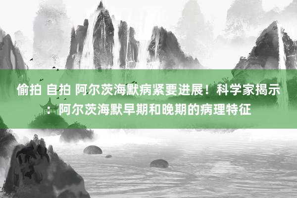 偷拍 自拍 阿尔茨海默病紧要进展！科学家揭示：阿尔茨海默早期和晚期的病理特征